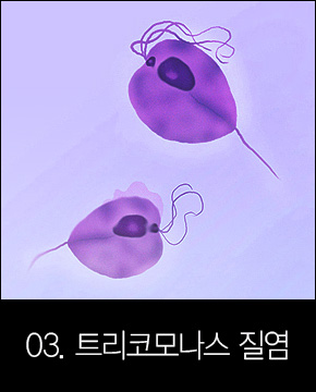 트리코모나스 질염